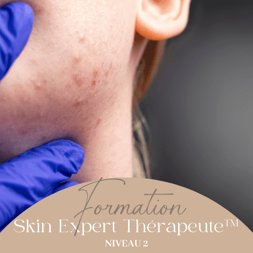 formation_experte_acne_e_learning